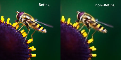 retina